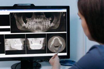 OPG Dental X-ray