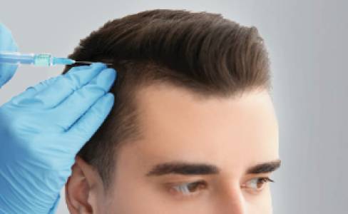 hair-transplantation