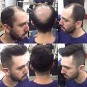 Hair Weaving