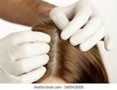 Analysis Of Scalp, Hair, and Cuticle