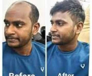 Hair Fixing