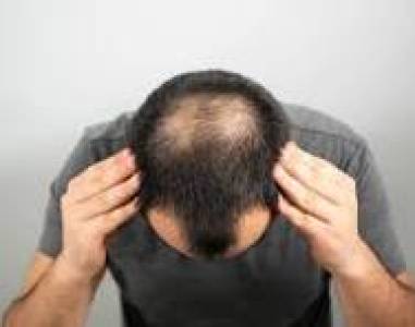 Non-Surgical Hair