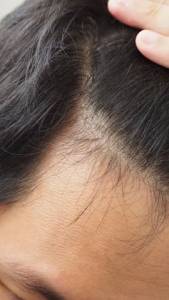 Hair Care Treatments