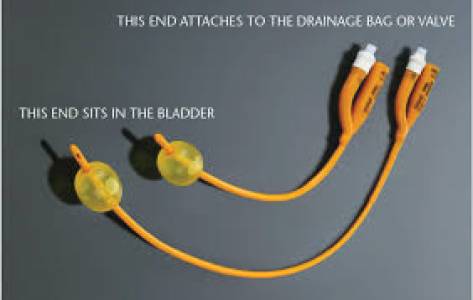 Catheter