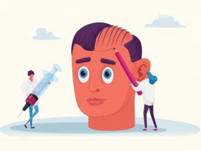 HAIR PATCH