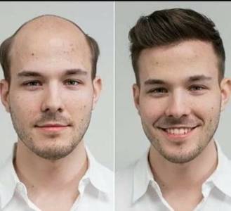 Mens Lace Hair Wig