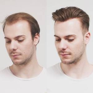 Hair Fixing