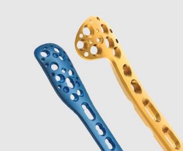 Orthopedic Trauma Implants