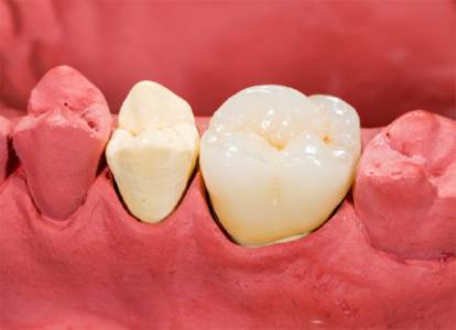 Restorative & Preventative