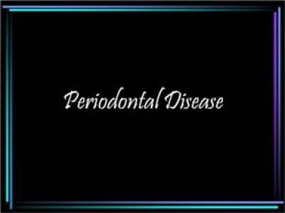 SCALING AND ORAL PROPHYLAXIS