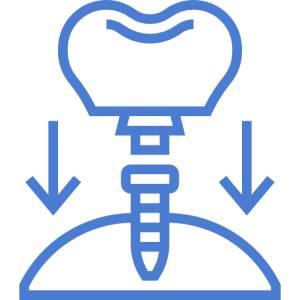 Teeth Aligners
