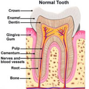 Root Canal
