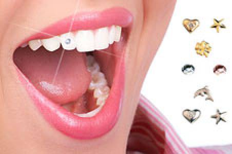 Dental Jewellery