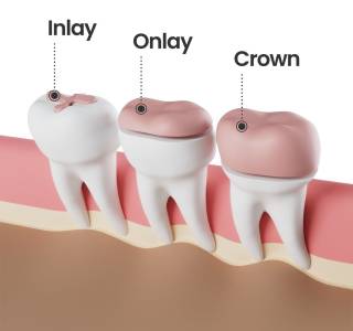 Restorative Dentistry