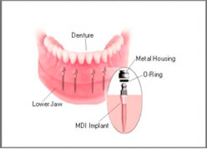 Restorative Dentistry