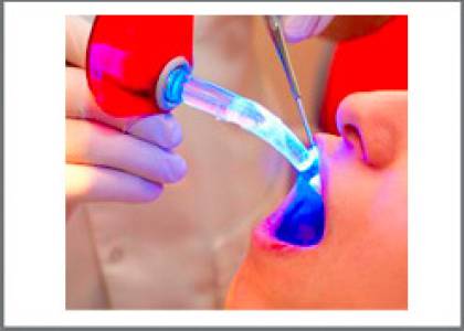Laser Dentistry