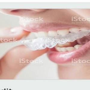 INVISALIGN DENTAL