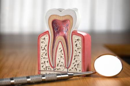 Root Canal Treatments