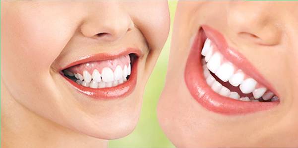 Facial Aesthetic Surgeries