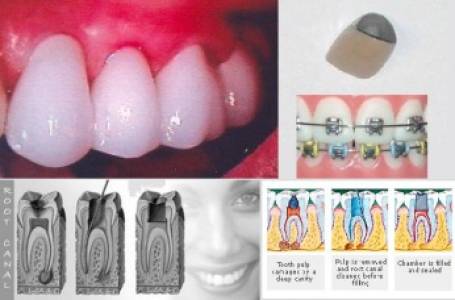 Dental Treatments