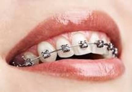 orthodontics