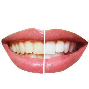 Cosmetic Dentistry