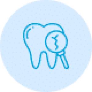 Root Canal Treatment