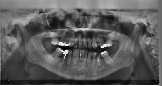 Dental Checkup and Xray