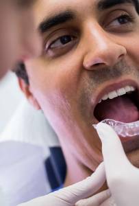 Orthodontic Treatments