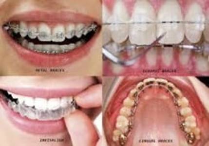 Orthodontic
