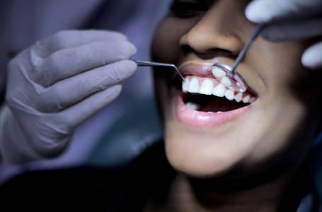 Root Canal Treatment