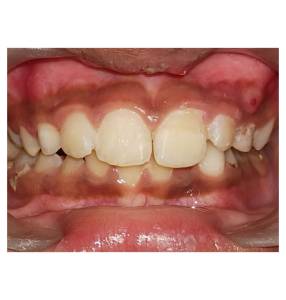 Dental Trauma Center