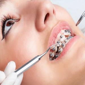 Orthodontics & Braces