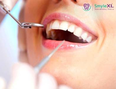 PREVENTIVE DENTISTRY