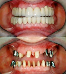 Specialized Treatments