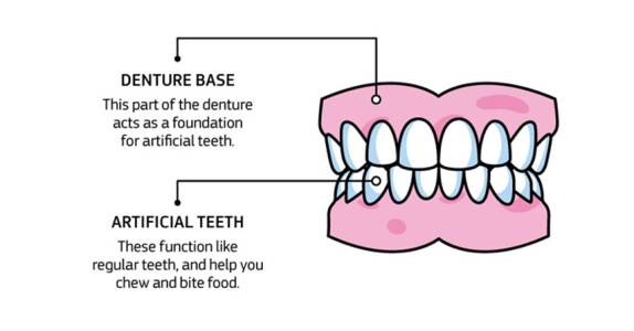 Complete Denture