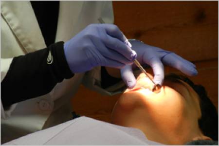 Removal of Wisdom Teeth