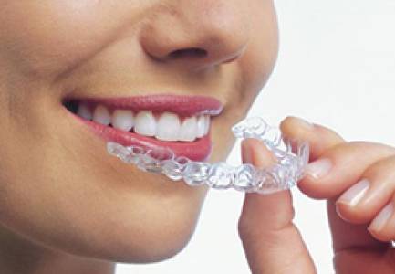 Braces/Invisalign Consultation