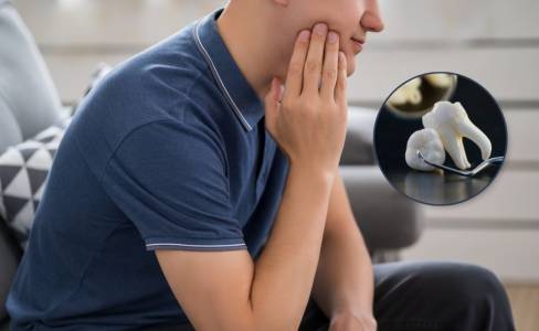 Wisdom Tooth Removal