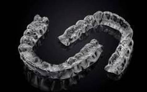 aligners