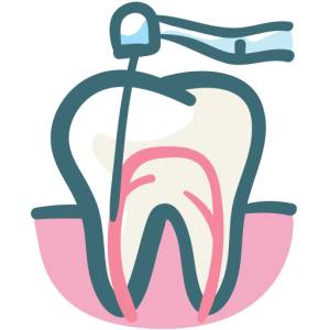 Root Canal Treatment