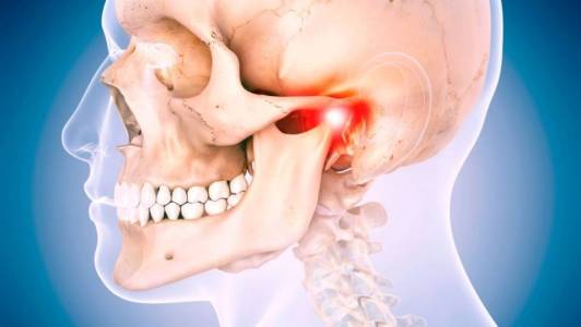 JAW PAIN TREATMENT