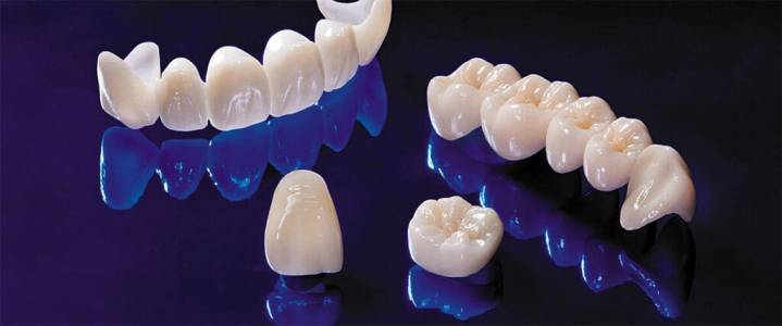 Ceramic crown in Pune