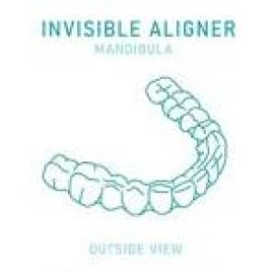 aligners