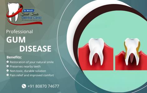 Gum Disease Treatment