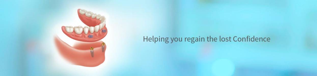 Implant Overdentures