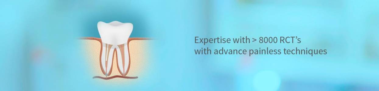 Painless Root Canal Treatment