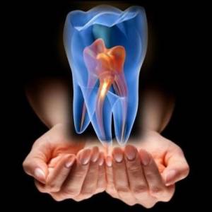 Root Canal treatment, RCT Single Sitting Root canal