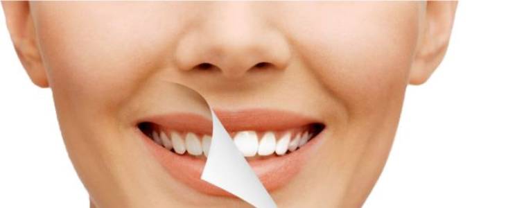 Dental Smile Makeovers