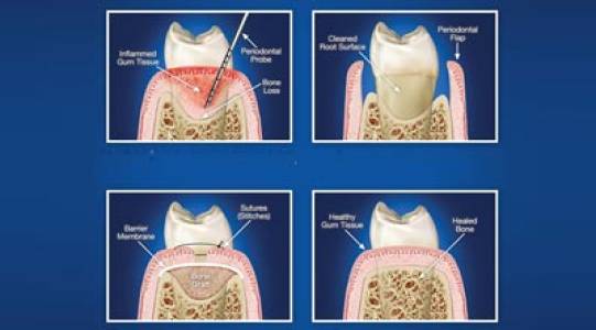 Periodontics